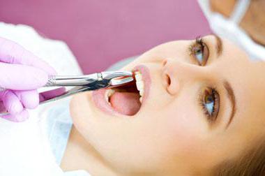 Merkit hampaan poistamiseksi periodontiitista